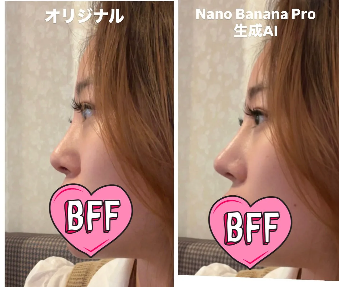 Ideal nose aesthetic details — After